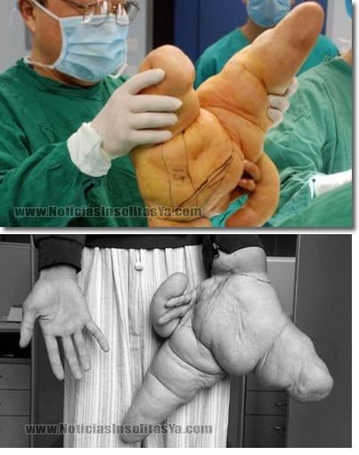 Liu hua-la-mano-mas-grande-del-mundo-desformaciones-insolita