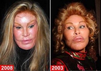 49c256841284b_354_249