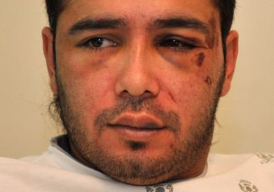 Golpeado en la Guanaca - PORTADA1