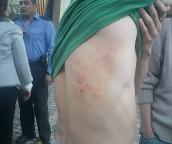 Golpeados por camioneros de moyano interior