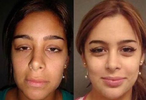 Larissa antes y despues1