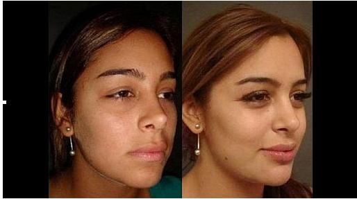 Larissa antes y despues2