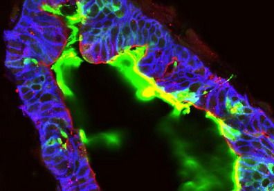 Imagen tejido intestino