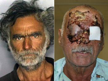 Víctima caníbal miami rudy eugene