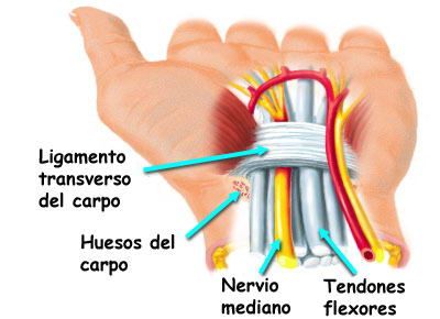 Tunel carpiano-sintomas-tunel-del-carpo