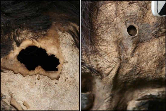 Trepanación craneal Perú 1