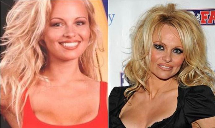 Pamela Anderson