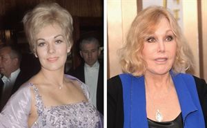 Kim novac antes y despues