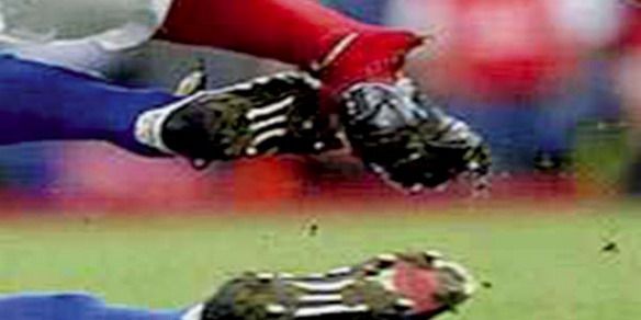 Fútbol - fractura