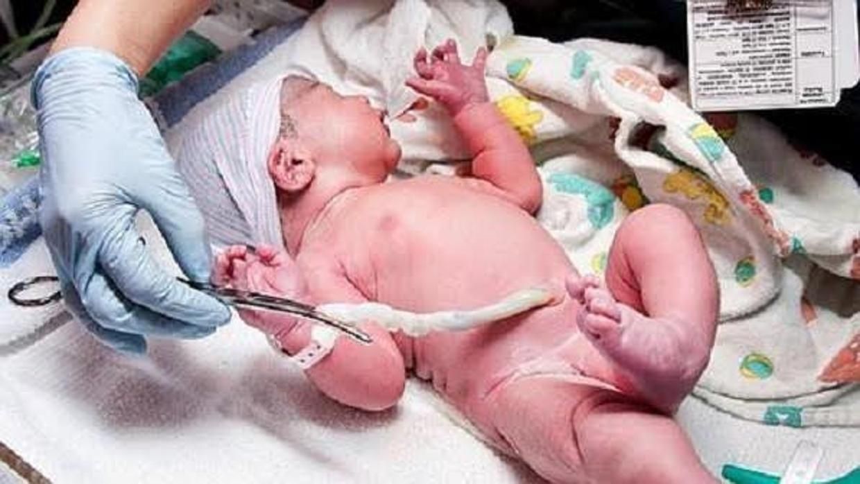 cordón umbilical células madres