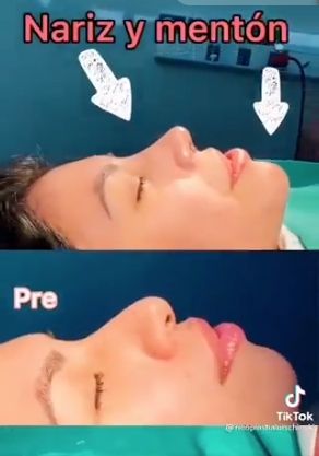 EL PROPIO FERRIOLS MOSTRO EL ANTES Y EL DESPUES.