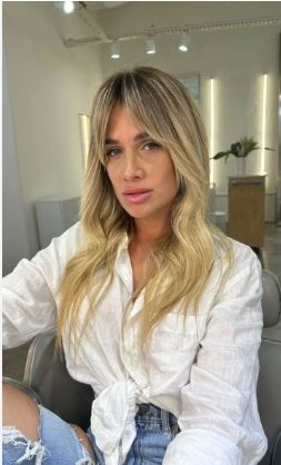 Otro posteo que prueba que se inyectó acído hialurónico