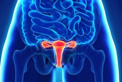 MDZol | En el día mundial de la endometriosis exploraremos sobre qué es esta enfermedad, cuáles son los síntomas particulares, su relación e impacto en la fertilidad y la microbiota. Foto: Archivo MDZ