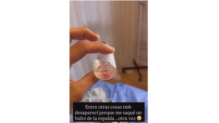 Así contó Cinthia que fue intervenida en cirugía. Así contó Cinthia que fue intervenida en cirugía.