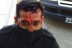 Uno de los policías heridos por querer suspender el partido de fútbol clandestino