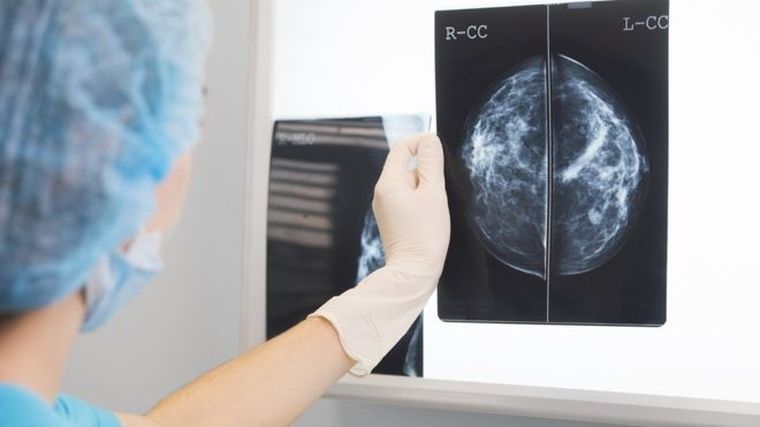 El sistema de inteligencia artificial fue tan preciso como dos médicos especialistas trabajando juntos.