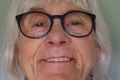 MDZol | Jo Cameron tiene mutaciones genéticas raras que hacen que casi no sienta dolor o ansiedad. Foto: PA MEDIA
