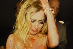 operaron a lady gaga: estoy viva, es solo un golpe en el camino