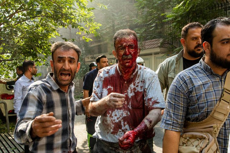 Irán sufre ataques de Estados Unidos y de Israel. Foto EFE Irán sufre ataques de Estados Unidos y de Israel. Foto EFE