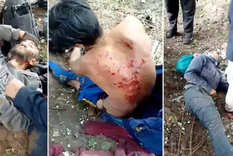 Las secuelas que les dejó el rayo a tres de las víctimas. Foto: gentileza. Las secuelas que les dejó el rayo a tres de las víctimas. Foto: gentileza.