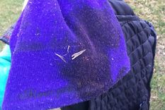 Sangre Así quedó la ropa del hombre: toda ensangrentada.