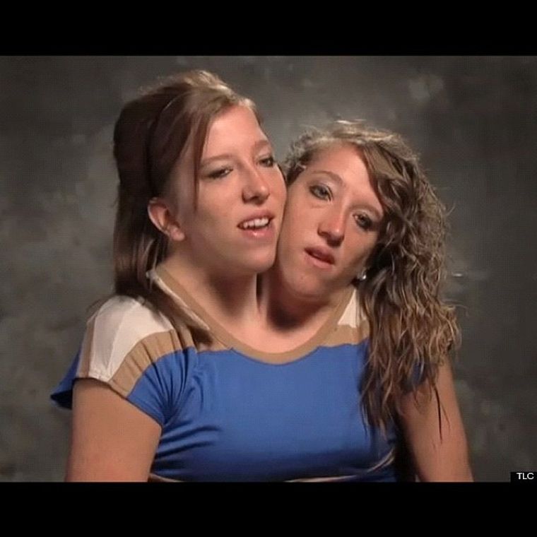 Las hermanas Hensel no logran salir del ojo público. Créditos: Instagram / abbyandbrittany