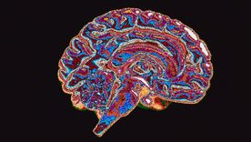 La neurociencia ha empezado a explorar cómo el poder político y el contexto institucional influyen en la actividad cerebral asociada a decisiones corruptas o inmorales.