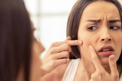 MDZol | ¿Qué hacer cuando aparecen puntos negros? (Shutterstock)