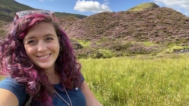 Foto: AILSA BURN-MURDOCH. Ailsa se sometió al mismo tratamiento que la modelo Linda Evangelista.