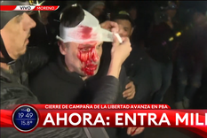 Un cronista de América fue herido durante el cierre de campaña de La Libertad Avanza. Foto: captura de video Un cronista de América fue herido durante el cierre de campaña de La Libertad Avanza. Foto: captura de video