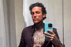 El antes y el después de una de las figuras más polémicas de la farándula argentina comenzó este martes. / Archivo MDZ