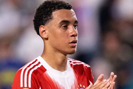 Jamal Musiala fue operado con éxito y estará varios meses fuera de las canchas Jamal Musiala fue operado con éxito y estará varios meses fuera de las canchas