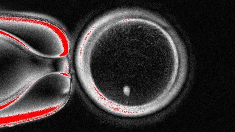 El círculo grande es el óvulo visto bajo un microscopio. El punto blanco en la parte inferior es el material genético tomado de una célula de la piel y colocado dentro.