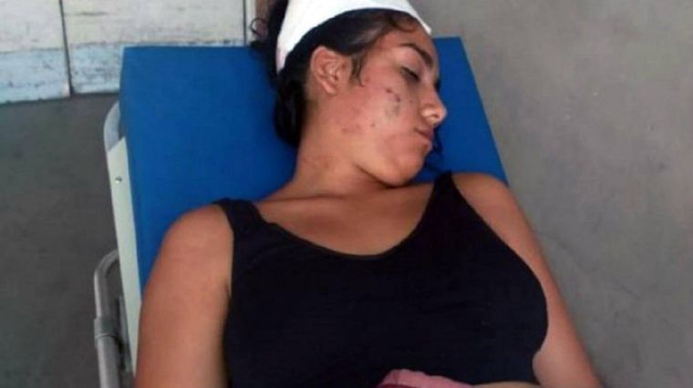 Candela continúa internada tras la golpiza que le dieron un hombre y diez mujeres