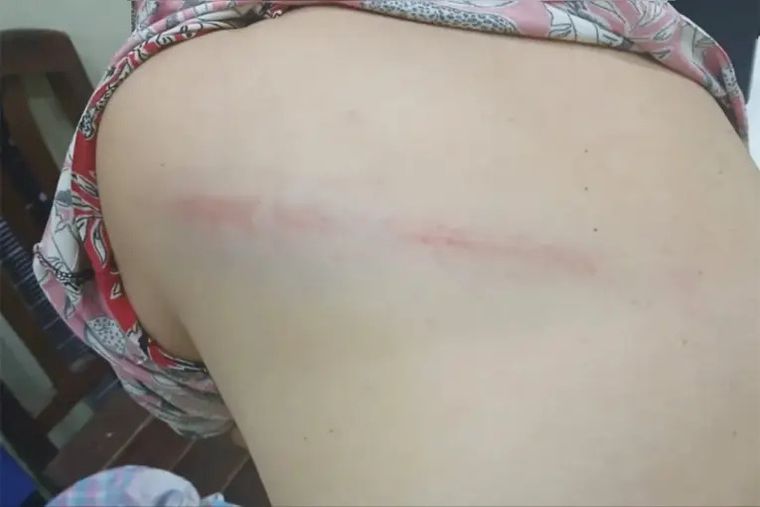 El hecho ocurrió en un domicilio ubicado en la localidad de Los Ardiles.