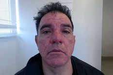 El hombre dejó a la mujer con severas heridas. Al ser trasladada al hospital, murió