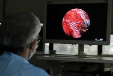 Un doctor indio practica una cirugía endoscópica a una persona que sufre mucormicosis en un hospital en Ghaziabad, la India, el 23 de mayo de 2021. Foto: Ap.