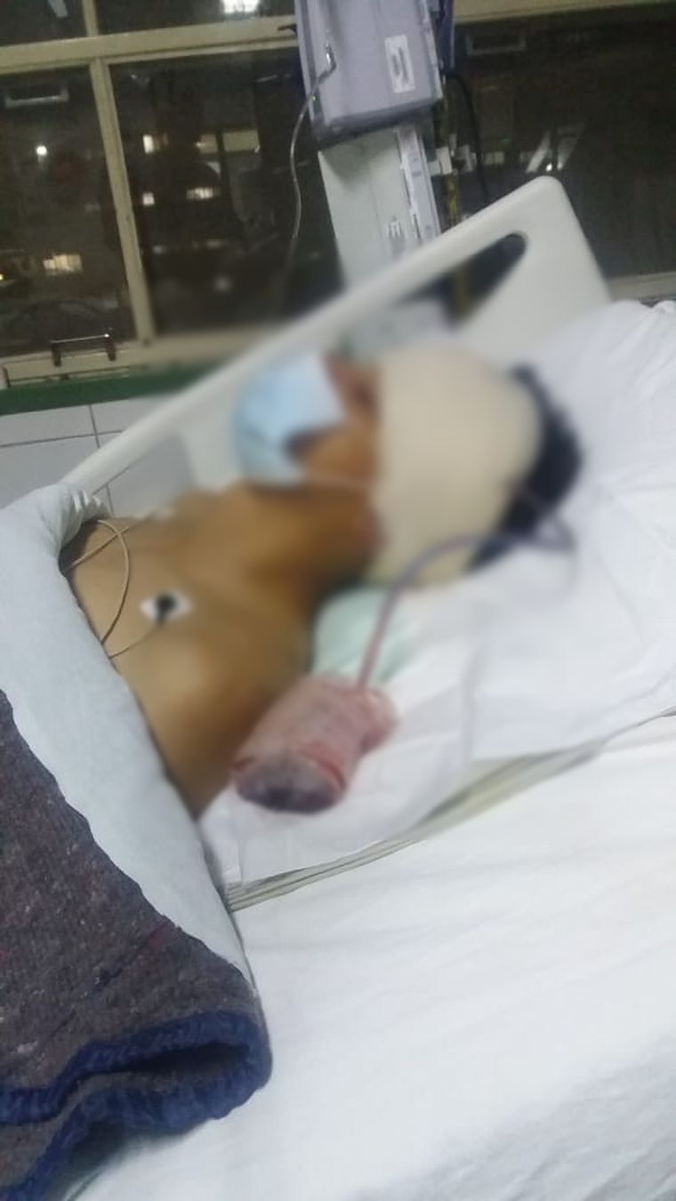 El joven se recupera lentamente de la paliza. Las fuertes imágenes fueron enviadas por su propia familia