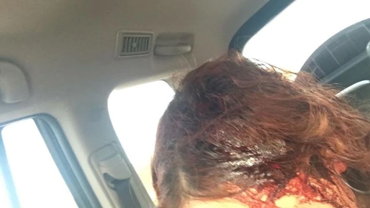Así quedó la joven agredida con el elemento cortante.