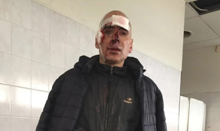 El maratonista herido Foto: NA