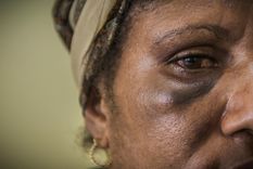 La mujer fue atacada salvajemente con un hierro. Imagen ilustrativa Foto: Médicos Sin Fronteras