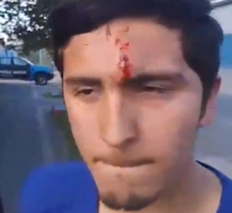 Militante libertario agredido en La Plata Foto: Captura de video