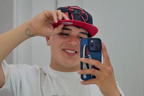 El ex GH sorprendió con fotos de cómo quedaron sus heridas. / @thi4go_km El ex GH sorprendió con fotos de cómo quedaron sus heridas. / @thi4go_km