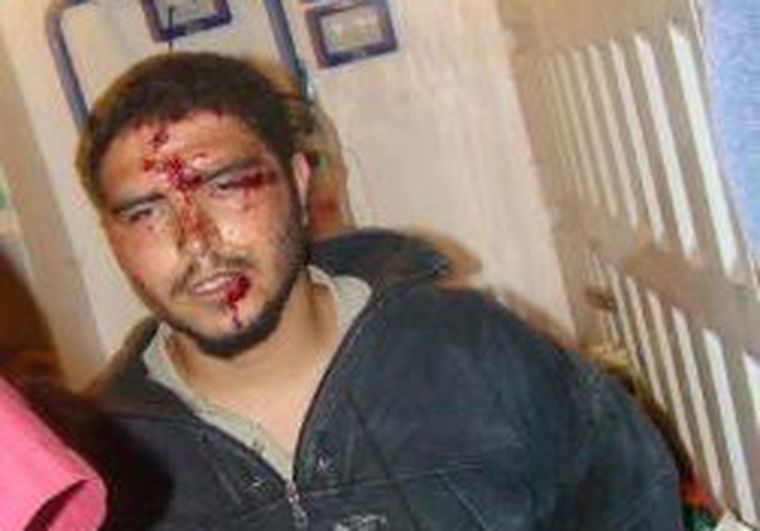 Marcos Reinoso, uno de los trabajadores heridos de la textil Pagoda. Foto: Cuyonoticias.com