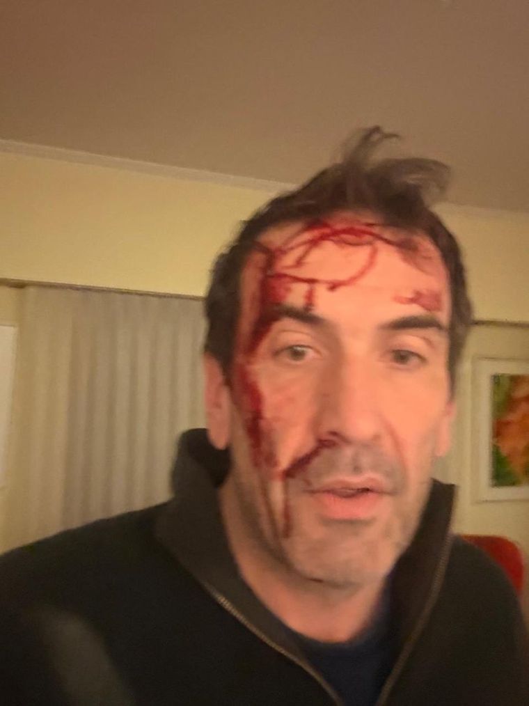 El candidato a senador por LLA fue brutalmente atacado a horas de las elecciones.