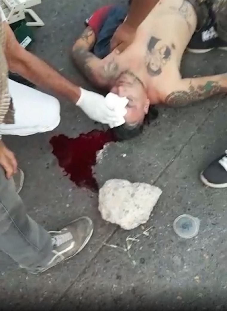 Así quedó uno de los sujetos tras se golpeado con una piedra