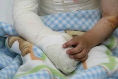 El niño está grave tras haberse quemado la mitad del cuerpo/Imagen Ilustrativa