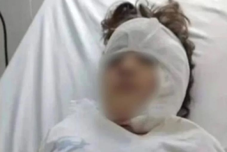 Un Pitbull atacó a una nena de 8 años y le desfiguró la cara en Río Gallegos Foto: NA