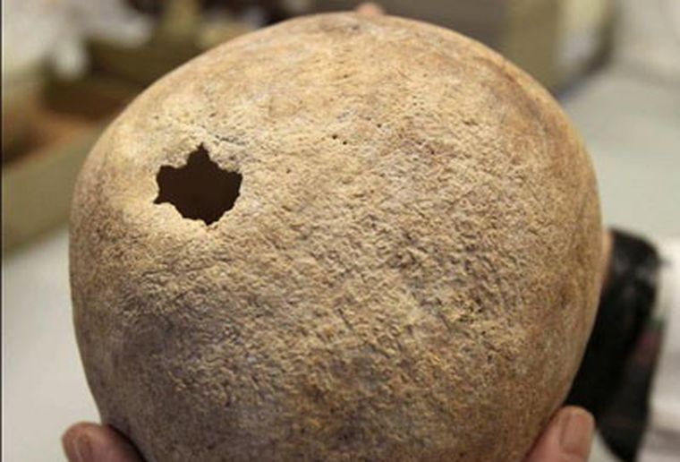 El cráneo trepanado. Foto: EFE