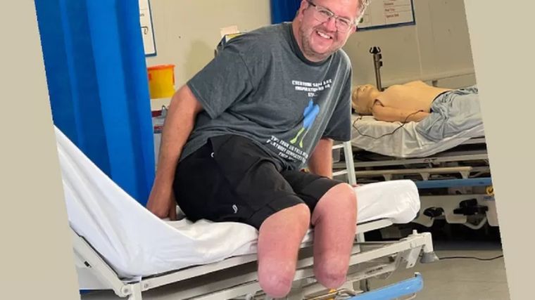 Neil Hopper desarrolló sepsis después de enfermarse en un viaje de campamento. Foto: INSTAGRAM / BIONICSURGEON